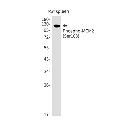 Phospho-MCM2 (Ser108)兔单抗,Phospho-MCM2 (Ser108) Rabbit Monoclonal Antibody