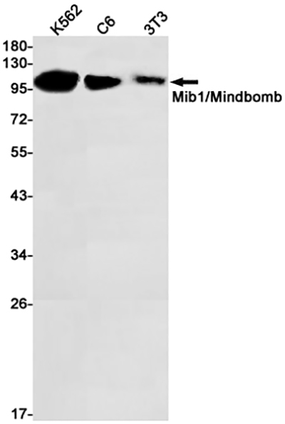 MIB1兔单抗,MIB1 Rabbit Monoclonal Antibody