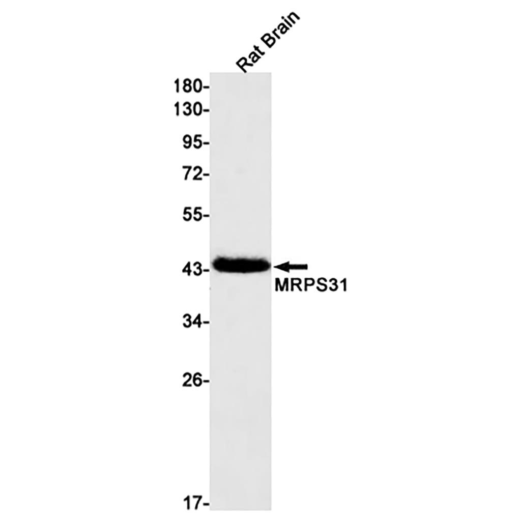 MRPS31兔单抗,MRPS31 Rabbit Monoclonal Antibody