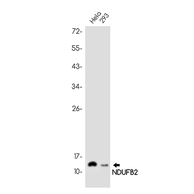 NDUFB2兔单抗,NDUFB2 Rabbit Monoclonal Antibody