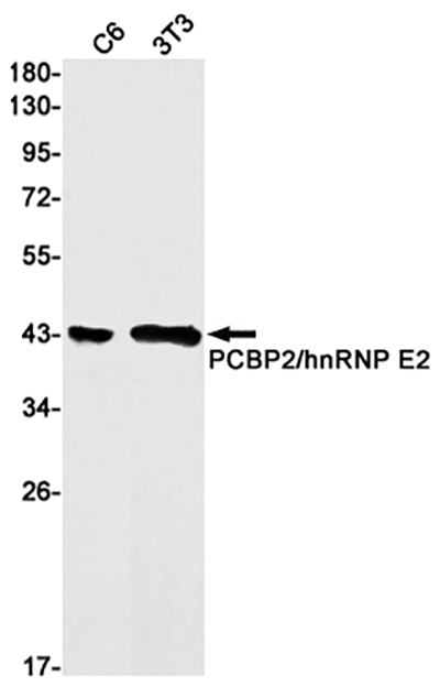 PCBP2兔单抗,PCBP2 Rabbit Monoclonal Antibody