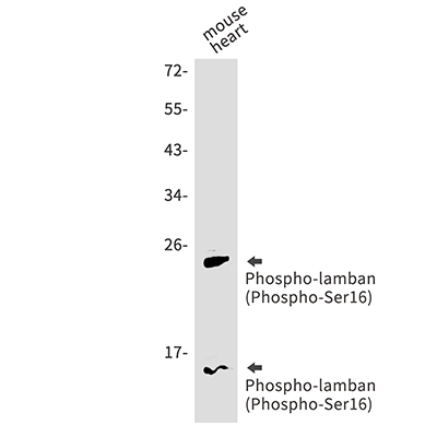 Phospho-Phospholamban (Ser16)兔单抗,Phospho-Phospholamban (Ser16) Rabbit Monoclonal Antibody