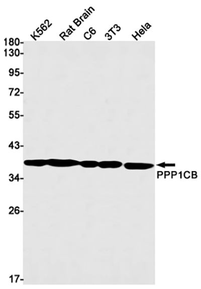 PP1C beta兔单抗,PP1C beta Rabbit Monoclonal Antibody