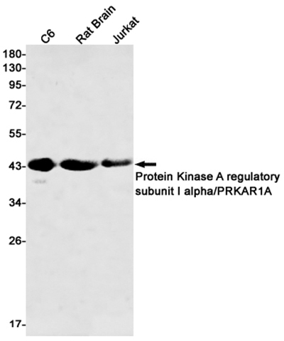 PKA RI alpha兔单抗,PKA RI alpha Rabbit Monoclonal Antibody
