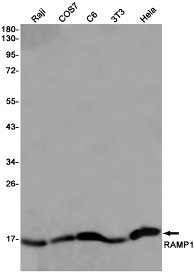 RAMP1兔单抗,RAMP1 Rabbit Monoclonal Antibody