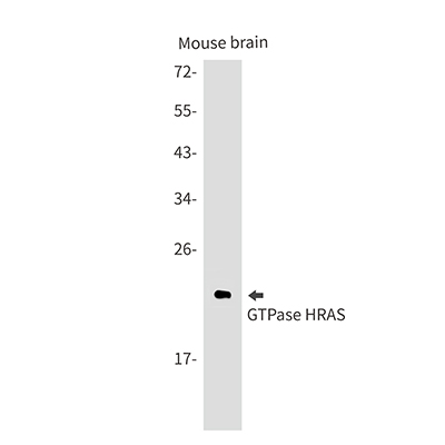 GTPase HRAS兔单抗,GTPase HRAS Rabbit Monoclonal Antibody