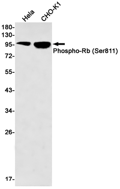 Phospho-Rb (Ser811)兔单抗,Phospho-Rb (Ser811) Rabbit Monoclonal Antibody