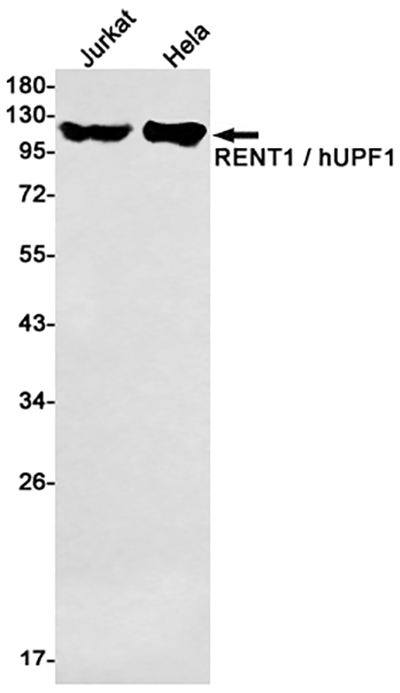 RENT1兔单抗,RENT1 Rabbit Monoclonal Antibody