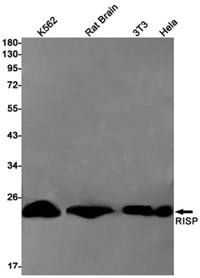 Complex III Subunit 5兔单抗,Complex III Subunit 5 Rabbit Monoclonal Antibody