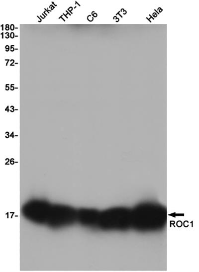 RBX1兔单抗,RBX1 Rabbit Monoclonal Antibody