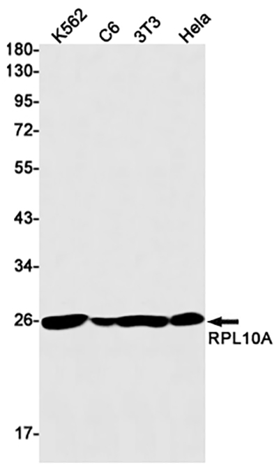 RPL10A兔单抗,RPL10A Rabbit Monoclonal Antibody