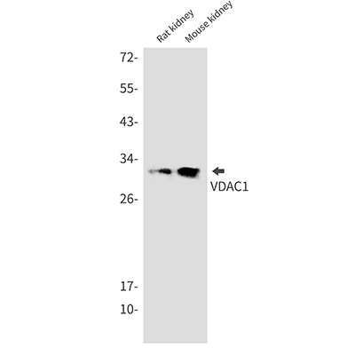 VDAC1兔单抗,VDAC1 Rabbit Monoclonal Antibody