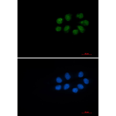 Phospho-Vimentin (Ser56)兔单抗,Phospho-Vimentin (Ser56) Rabbit Monoclonal Antibody