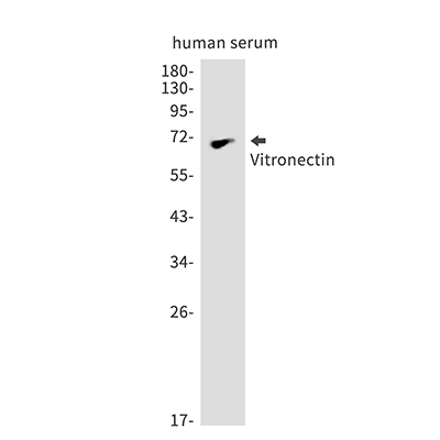 Vitronectin兔单抗,Vitronectin Rabbit Monoclonal Antibody