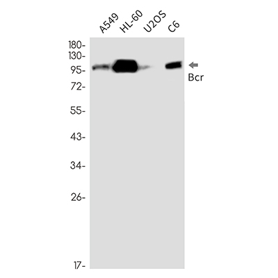 Bcr兔单抗,Bcr Rabbit Monoclonal Antibody