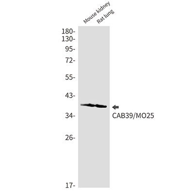 CAB39兔单抗,CAB39 Rabbit Monoclonal Antibody