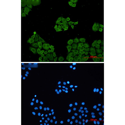 CLIC1兔单抗,CLIC1 Rabbit Monoclonal Antibody