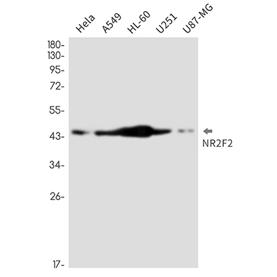 NR2F2兔单抗,NR2F2 Rabbit Monoclonal Antibody