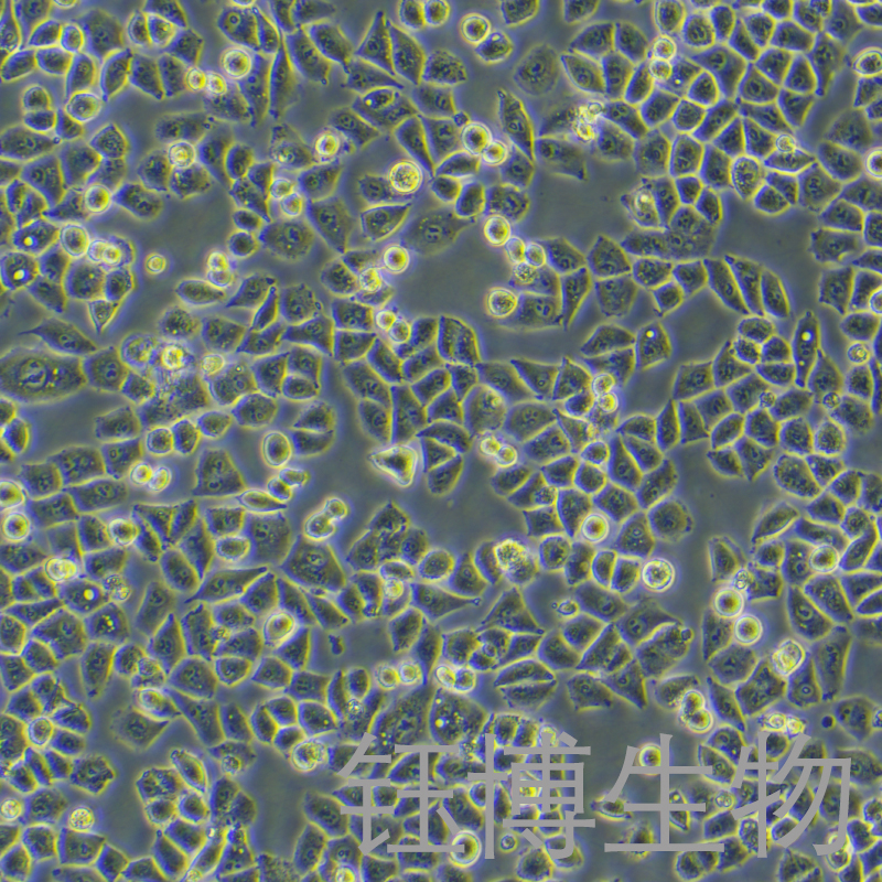 IOSE-80（人正常卵巢上皮细胞）YB-71809HC,IOSE-80