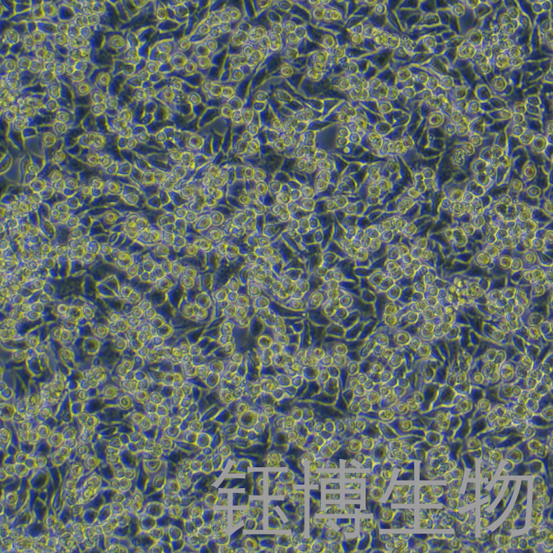 MB-49（小鼠膀胱癌细胞）YB-7034MC,MB-49