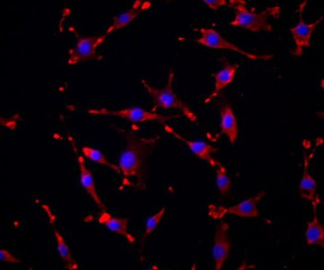 人支气管平滑肌细胞,Human bronchial smooth muscle cells