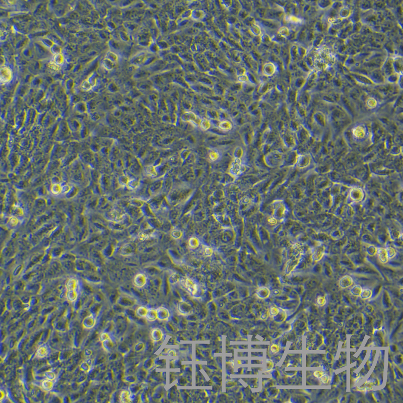 THLE-2（人正常肝细胞）YB-71812HC,THLE-2