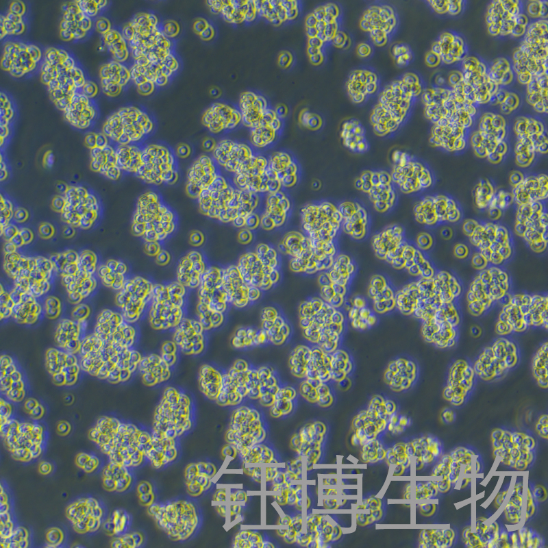 A20（小鼠B细胞淋巴瘤细胞）YB-7037MC,A20