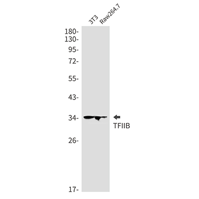 Transcription Initiation Factor IIB兔单抗,Transcription Initiation Factor IIB Rabbit Monoclonal Antibody
