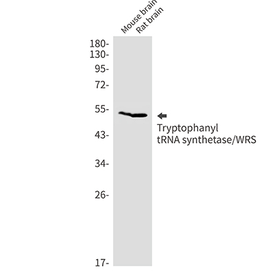 Tryptophan tRNA Ligase兔单抗,Tryptophan tRNA Ligase Rabbit Monoclonal Antibody