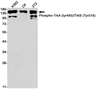 Phospho-TrkA/B (Tyr490/Tyr516)兔单抗,Phospho-TrkA/B (Tyr490/Tyr516) Rabbit Monoclonal Antibody