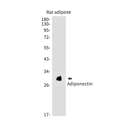 Adiponectin兔单抗,Adiponectin Rabbit Monoclonal Antibody