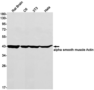 alpha Smooth Muscle Actin兔单抗,alpha Smooth Muscle Actin Rabbit Monoclonal Antibody