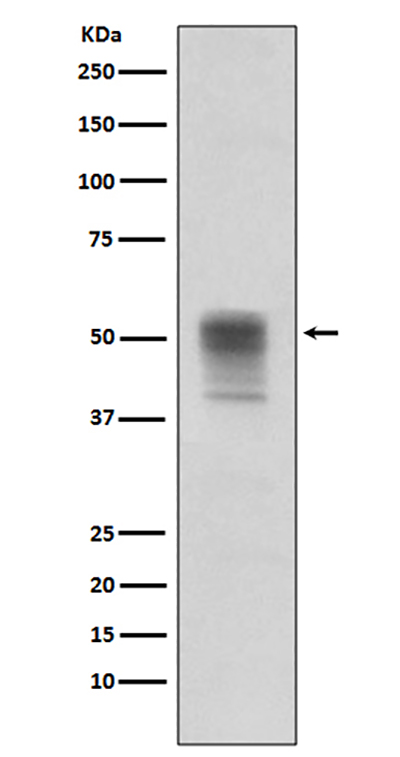 Phospho-alpha Tubulin (Tyr272)兔单抗,Phospho-alpha Tubulin (Tyr272) Rabbit Monoclonal Antibody