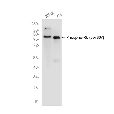 Phospho-Rb (Ser807)兔单抗,Phospho-Rb (Ser807) Rabbit Monoclonal Antibody