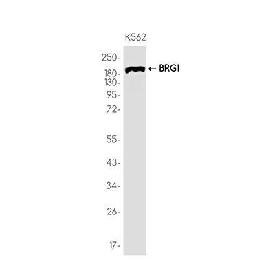 BRG1兔单抗,BRG1 Rabbit Monoclonal Antibody