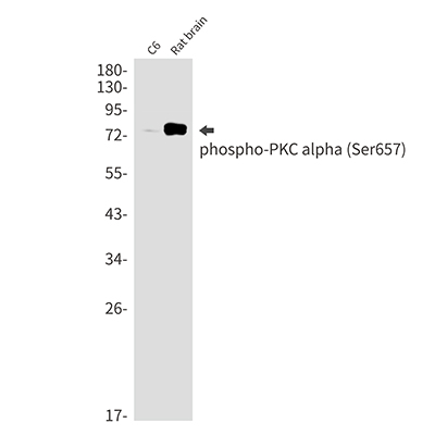 Phospho-PKC alpha (Ser657)兔单抗,Phospho-PKC alpha (Ser657) Rabbit Monoclonal Antibody
