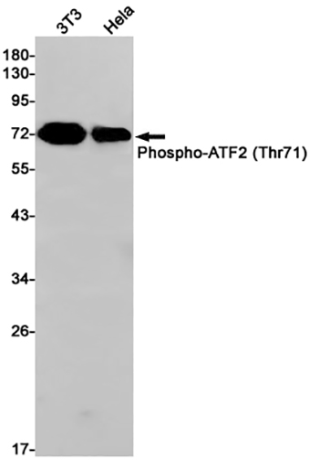 Phospho-ATF2 (T71) (7E18)兔单抗,Phospho-ATF2 (T71) (7E18) Rabbit Monoclonal Antibody