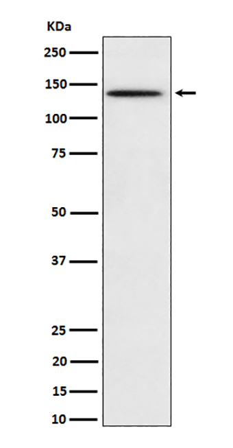 Phospho-BCAR1 (Y410) (17X7)兔单抗,Phospho-BCAR1 (Y410) (17X7) Rabbit Monoclonal Antibody