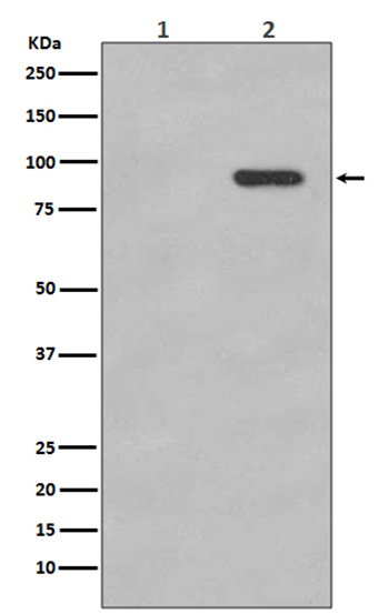 Phospho-beta Catenin (S33/S37) (7V18)兔单抗,Phospho-beta Catenin (S33/S37) (7V18) Rabbit Monoclonal Antibody