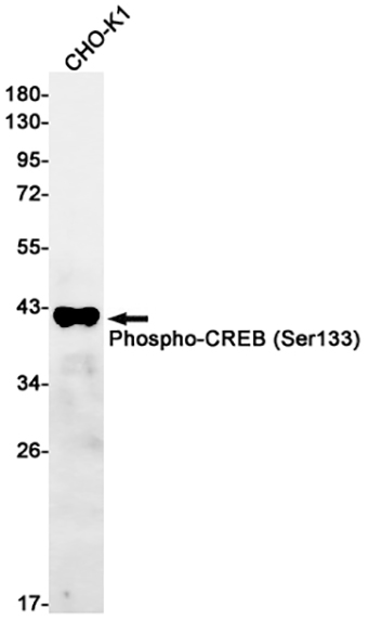 Phospho-CREB (Ser133) (11Z4)兔单抗,Phospho-CREB (Ser133) (11Z4) Rabbit Monoclonal Antibody