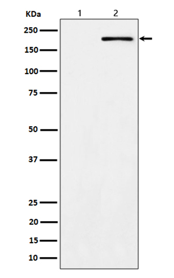 Phospho-ErbB2 (Y1139) (12W6)兔单抗,Phospho-ErbB2 (Y1139) (12W6) Rabbit Monoclonal Antibody