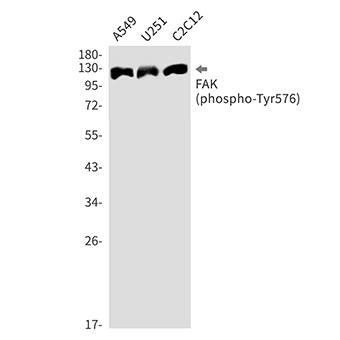 Phospho-FAK (Tyr576) (17X9)兔单抗,Phospho-FAK (Tyr576) (17X9) Rabbit Monoclonal Antibody