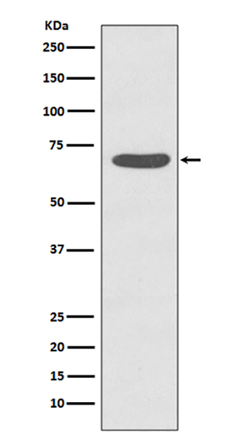 Phospho-PKC zeta (T560) (14P10)兔单抗,Phospho-PKC zeta (T560) (14P10) Rabbit Monoclonal Antibody