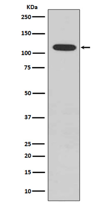 Phospho-Retinoblastoma (S807)  (4H3)兔单抗,Phospho-Retinoblastoma (S807)  (4H3) Rabbit Monoclonal Antibody