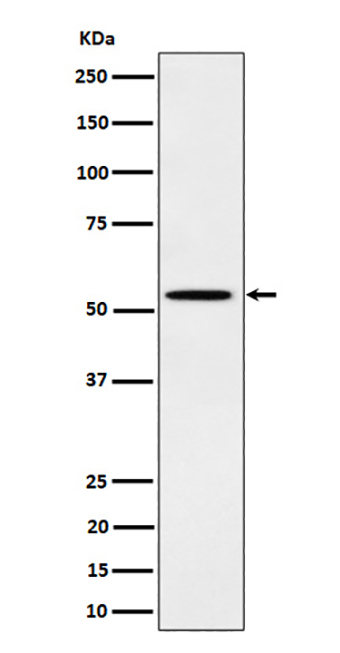 Phospho-Src (Y529) (9B14)兔单抗,Phospho-Src (Y529) (9B14) Rabbit Monoclonal Antibody