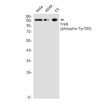 Phospho-TrkB (Tyr705) (3T18)兔单抗,Phospho-TrkB (Tyr705) (3T18) Rabbit Monoclonal Antibody
