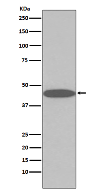 45569(2Y12)兔单抗,45569(2Y12) Rabbit Monoclonal Antibody
