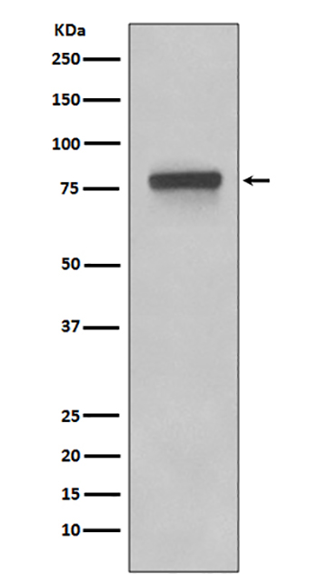 5T4 (9W4)兔单抗,5T4 (9W4) Rabbit Monoclonal Antibody