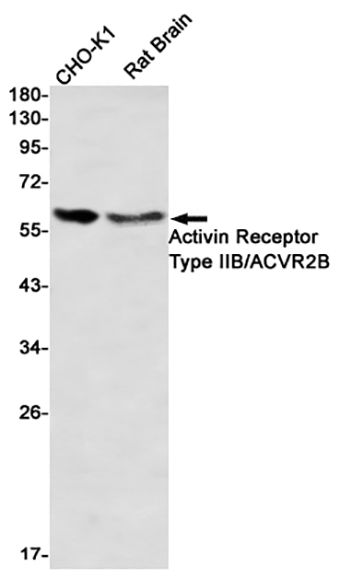 Activin Receptor Type IIB/ACVR2B (2S5)兔单抗,Activin Receptor Type IIB/ACVR2B (2S5) Rabbit Monoclonal Antibody