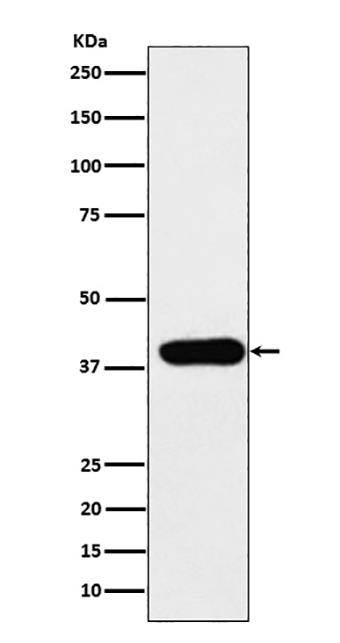ADA (11N15)兔单抗,ADA (11N15) Rabbit Monoclonal Antibody